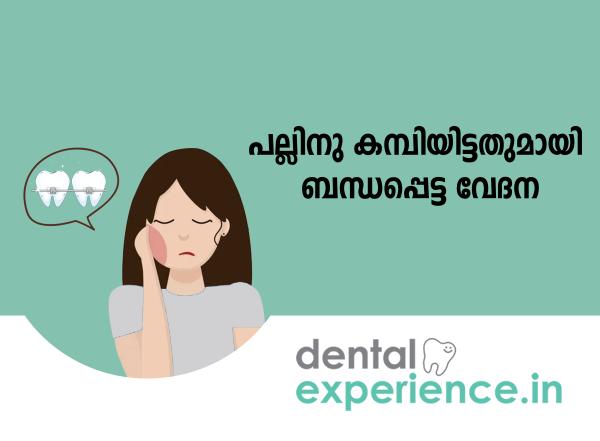 Pain of Orthodontic Treatment